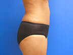 RGV Cosmetic Surgery Vein Care 