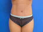 RGV Cosmetic Surgery Vein Care 