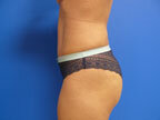 RGV Cosmetic Surgery Vein Care 