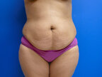RGV Cosmetic Surgery Vein Care 