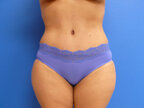 RGV Cosmetic Surgery Vein Care 