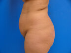 RGV Cosmetic Surgery Vein Care 