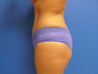 RGV Cosmetic Surgery Vein Care 
