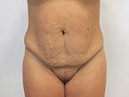 RGV Cosmetic Surgery Vein Care 