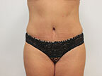 RGV Cosmetic Surgery Vein Care 