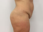 RGV Cosmetic Surgery Vein Care 