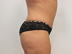 RGV Cosmetic Surgery Vein Care 