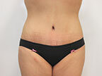RGV Cosmetic Surgery Vein Care 