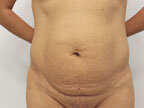 RGV Cosmetic Surgery Vein Care 
