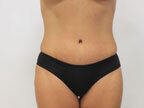 RGV Cosmetic Surgery Vein Care 
