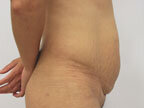 RGV Cosmetic Surgery Vein Care 