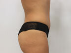 RGV Cosmetic Surgery Vein Care 