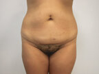 RGV Cosmetic Surgery Vein Care 
