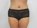 RGV Cosmetic Surgery Vein Care 