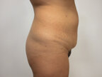 RGV Cosmetic Surgery Vein Care 