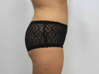 RGV Cosmetic Surgery Vein Care 