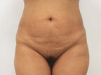 RGV Cosmetic Surgery Vein Care 