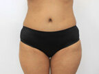 RGV Cosmetic Surgery Vein Care 