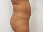 RGV Cosmetic Surgery Vein Care 