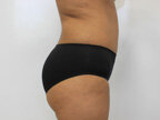 RGV Cosmetic Surgery Vein Care 