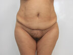 RGV Cosmetic Surgery Vein Care 
