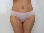 RGV Cosmetic Surgery Vein Care 