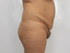RGV Cosmetic Surgery Vein Care 