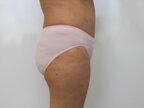 RGV Cosmetic Surgery Vein Care 