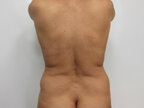 RGV Cosmetic Surgery Vein Care 