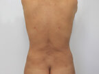 RGV Cosmetic Surgery Vein Care 