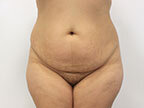 RGV Cosmetic Surgery Vein Care 