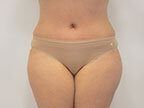 RGV Cosmetic Surgery Vein Care 