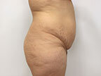 RGV Cosmetic Surgery Vein Care 