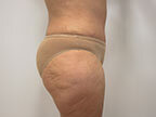 RGV Cosmetic Surgery Vein Care 