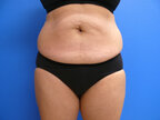 RGV Cosmetic Surgery Vein Care 
