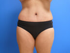 RGV Cosmetic Surgery Vein Care 