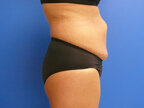 RGV Cosmetic Surgery Vein Care 