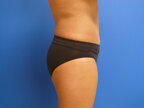 RGV Cosmetic Surgery Vein Care 