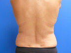 RGV Cosmetic Surgery Vein Care 