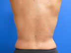 RGV Cosmetic Surgery Vein Care 