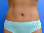 RGV Cosmetic Surgery Vein Care 