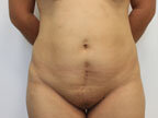RGV Cosmetic Surgery Vein Care 