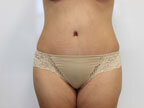 RGV Cosmetic Surgery Vein Care 