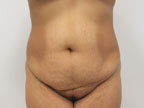 RGV Cosmetic Surgery Vein Care 