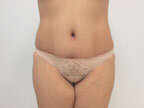 RGV Cosmetic Surgery Vein Care 