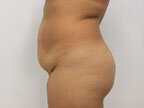 RGV Cosmetic Surgery Vein Care 