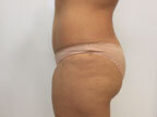 RGV Cosmetic Surgery Vein Care 