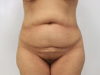 RGV Cosmetic Surgery Vein Care 