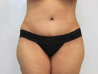 RGV Cosmetic Surgery Vein Care 