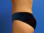RGV Cosmetic Surgery Vein Care 